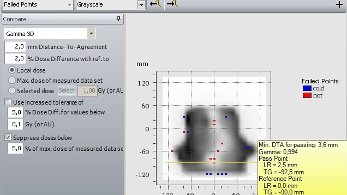 2D or 3D Gamma calculations with multiple options for advanced quantitative comparison