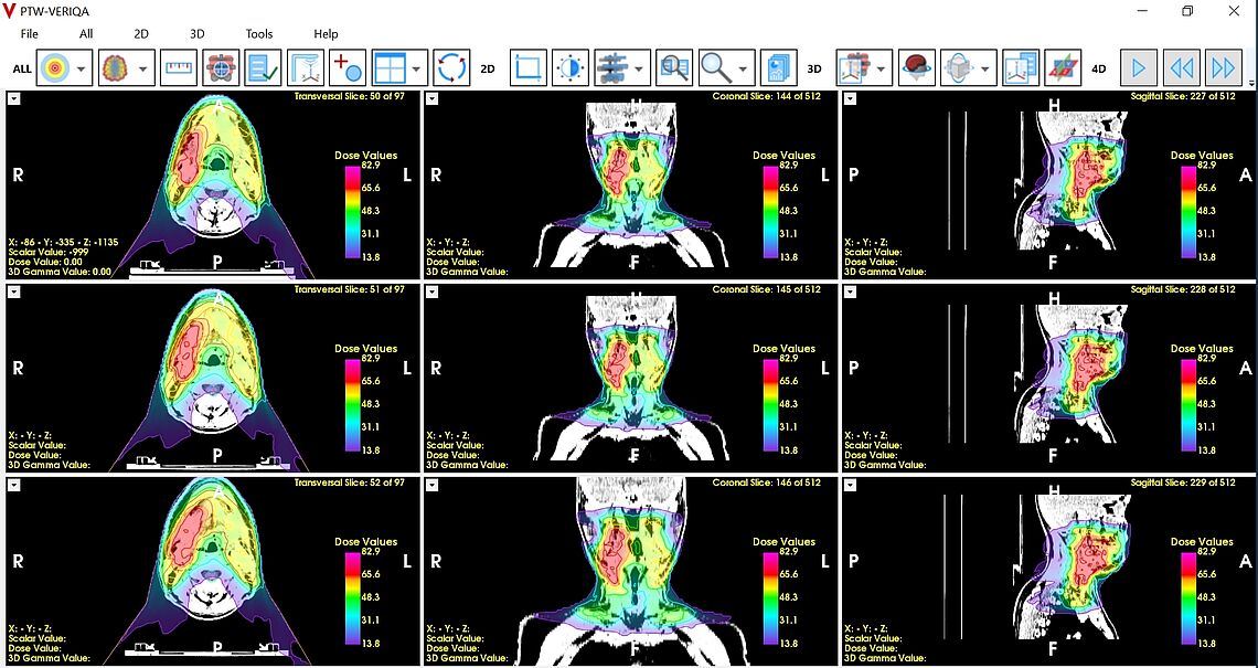 VERIQA RT View Software compares multiple treatment plans side by side.