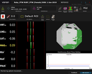 Check SGRT system after CBCT and record the deviation