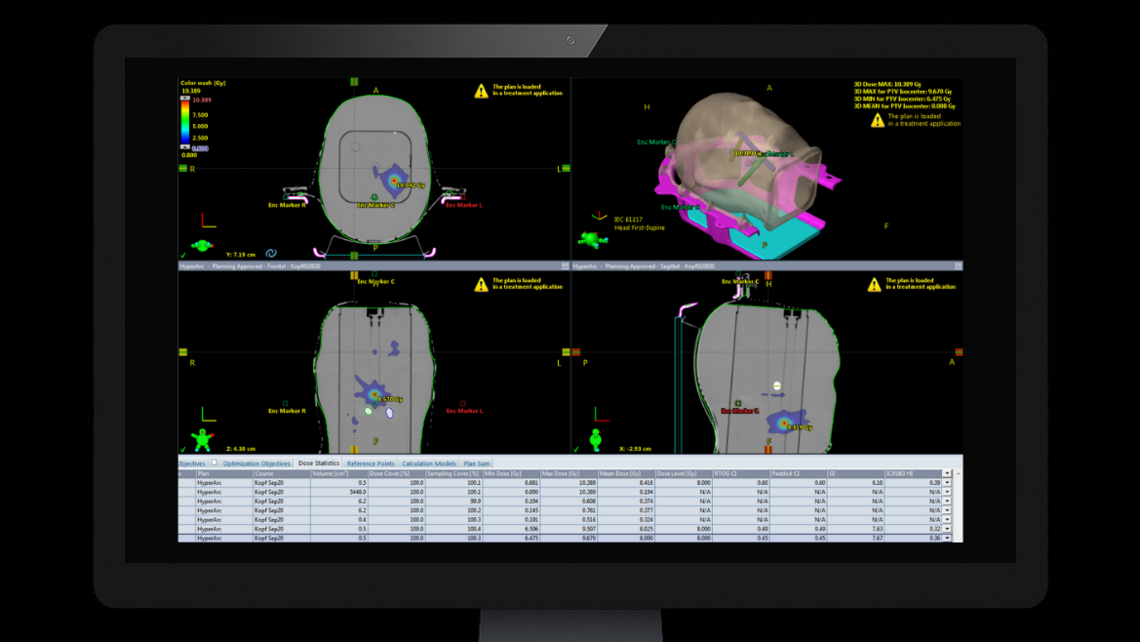 RUBY head phantom: Single isocenter treatment plan optimized on RUBY head phantom and System QA MultiMet insert with Eclipse Hyperarc.