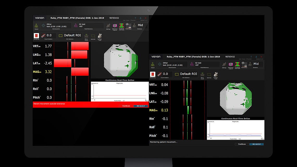 LINAC QA Table alignment checks using VARIAN OSMS: Left: RUBY with LINAC QA insert is setup on patient couch with defined offset (grey line). Misalignment (translation) is detected by OSMS. Right: RUBY after CBCT imaging and needed table shift –  phantom position matches reference data set.