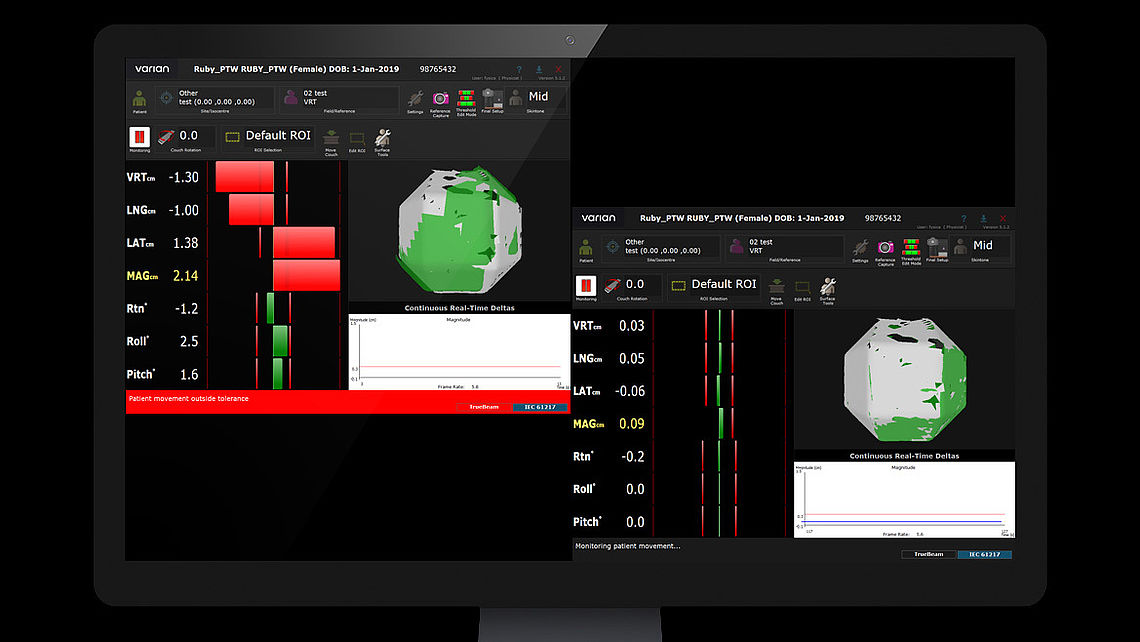 LINAC QA Table alignment checks using VARIAN OSMS: Left: RUBY with LINAC QA insert and tiling base is set up on patient couch with defined offset (red line). Misalignment (translation/rotation) is detected by OSMS. Right: RUBY after CBCT imaging and needed table shift and rotation –  phantom position matches reference data set.