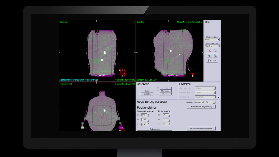 RUBY head phantom: CBCT imaging using Elekta XVI software of RUBY head phantom with System QA MultiMet insert.