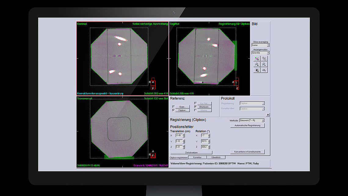 LINAC QA Fusion of RUBY CBCT and planning CT images (with tilting base): System detects misalignment, including phantom tilt.