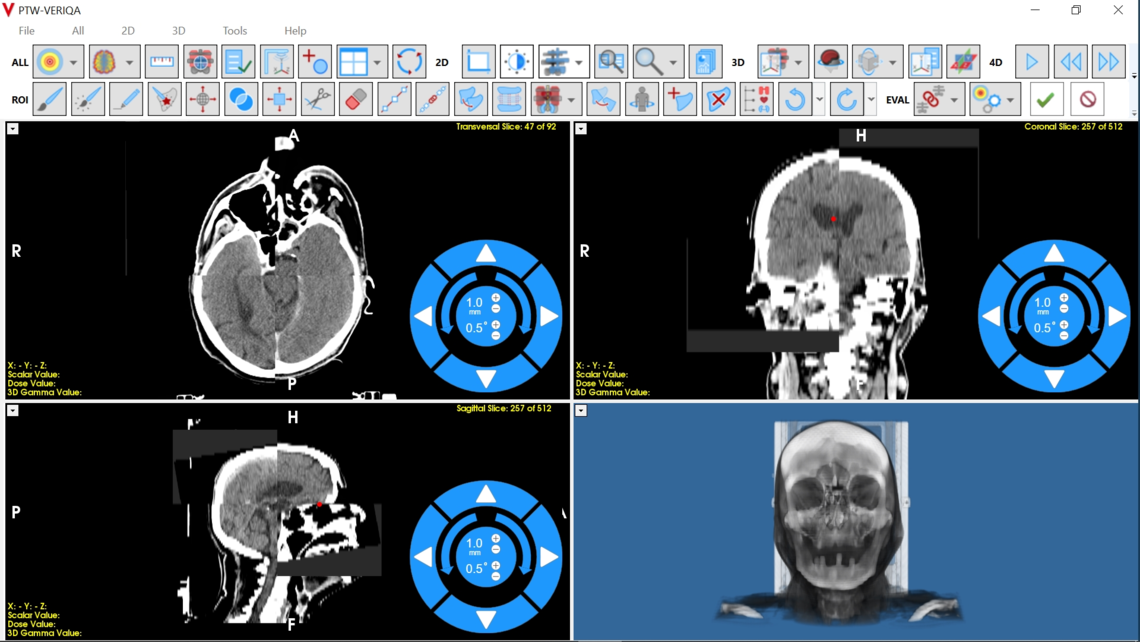 VERIQA visualization tools for plan review: rigid and deformable image registration