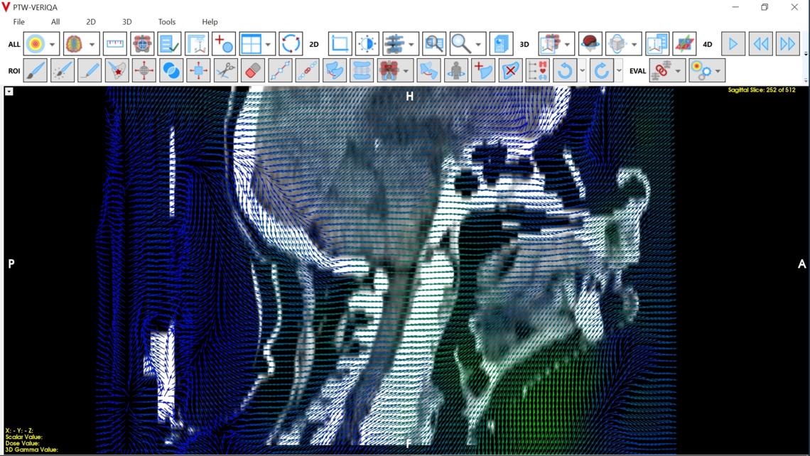VERIQA visualization tools for plan review: visualization of deformable vector fields