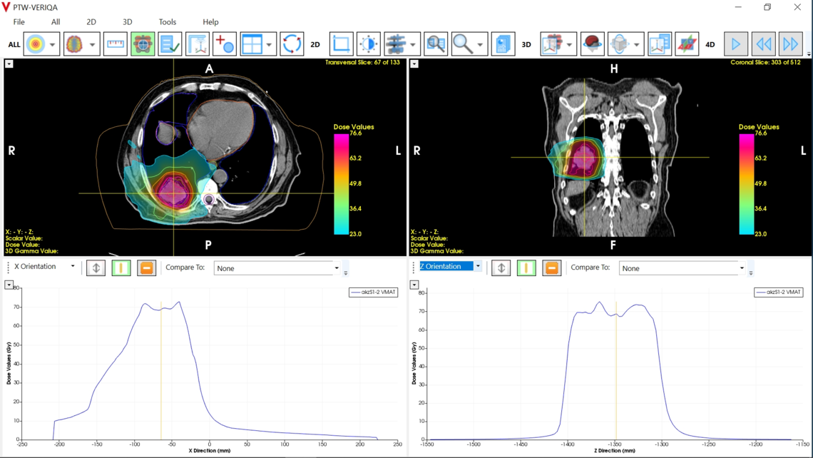 VERIQA visualization tools for plan review: dose profile plotting