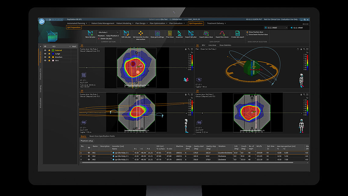 SYSTEM QA Treatment plan calculated on RUBY phantom with System QA insert using RayStation treatment planning system