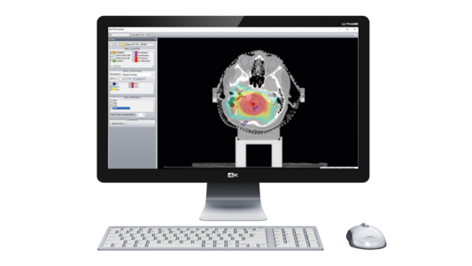 Evaluation in Patient Geometry