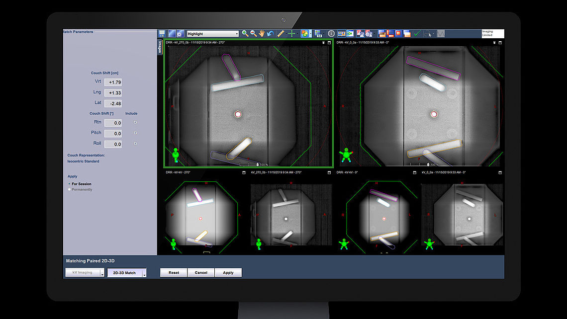 LINAC QA Alignment errors detected using kV images generated by VARIAN TrueBeam system