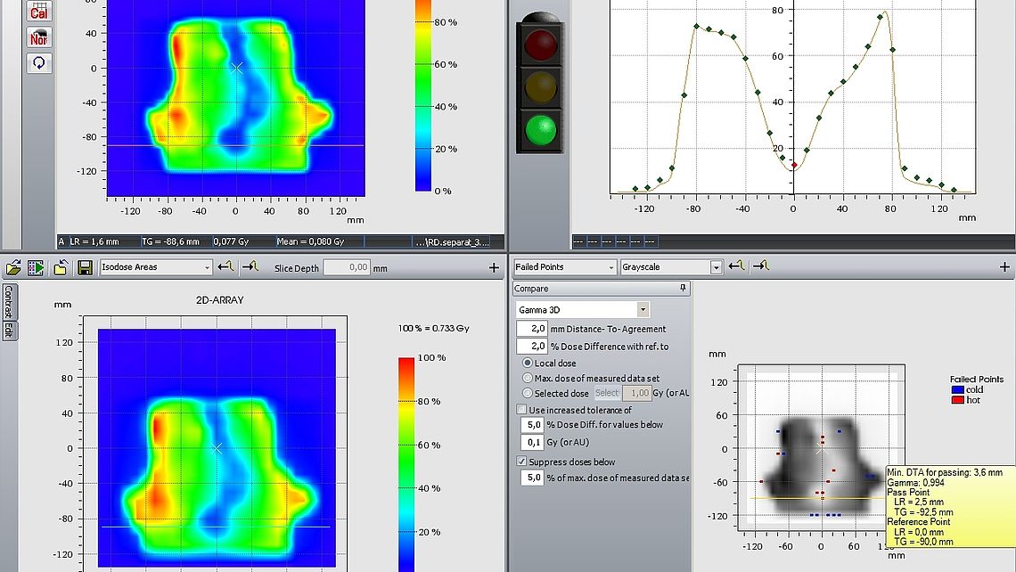 Profile and dose distribution overlays for basic visual comparison