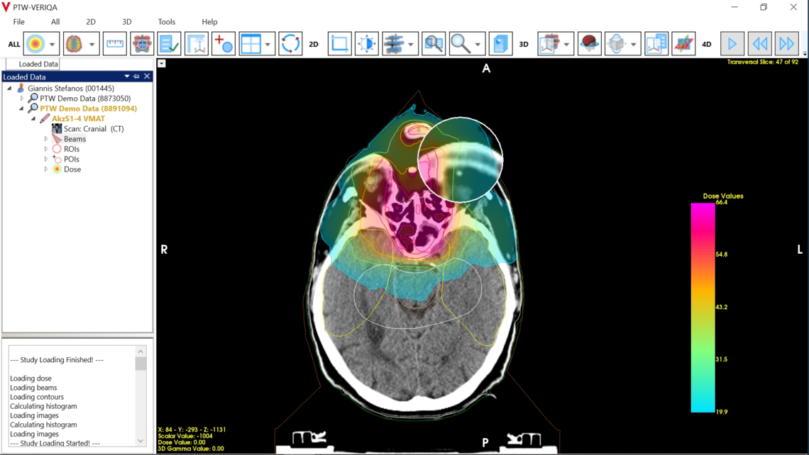 VERIQA visualization tools for plan review: magnification of selected regions