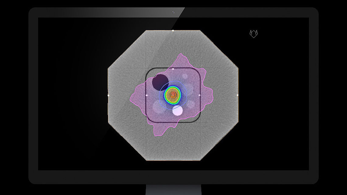 SYSTEM QA Treatment plan calculated on RUBY phantom with SYSTEM QA insert as shown in the treatment planning system. The different cavities (lung, brain, bone, MRI) are clearly visible on the image. CT markers in the base phantom and insert are well detected, allowing an accurate positioning of the isocenter.