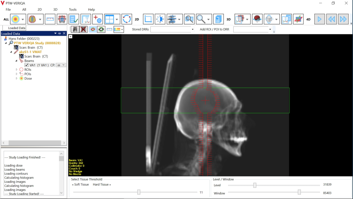 VERIQA visualization tools for plan review: DRR generation and field projection with adjustable soft tissue & bone