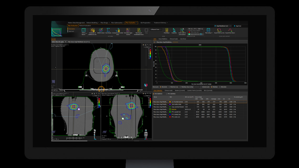RUBY head phantom: Single isocenter treatment plan optimized on RUBY head phantom and System QA MultiMet insert with Raystation, 20 mm target volume diameter.