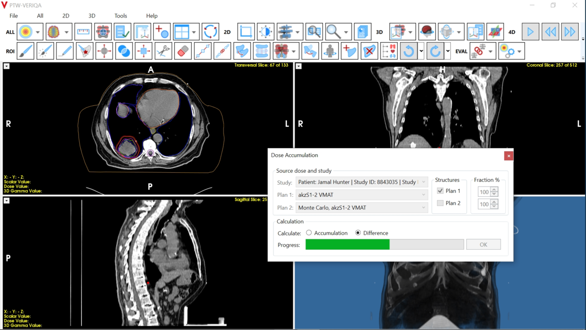VERIQA visualization tools for plan review: dose accumulation and calculation of dose differences