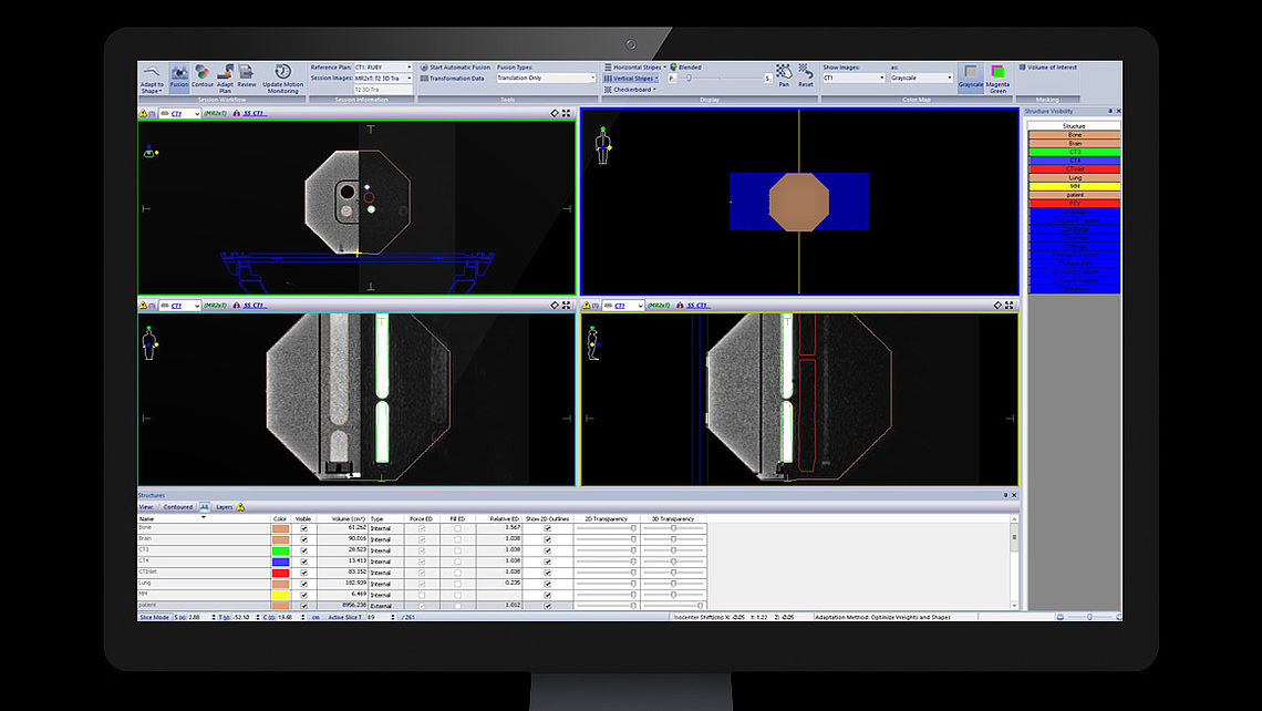 System QA  RUBY phantom set up on Elekta Unity: Image registration during patient workflow in Monaco treatment planning system